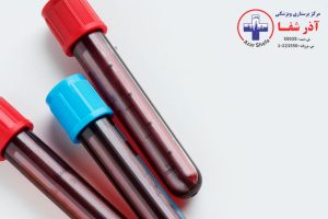 علت پلاکت خون بالا یا ترومبوسیتوز چیست؟